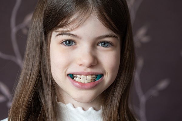 Three Common Types Of Early Orthodontic Treatment